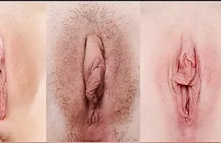 Ziemlich wund und Fo ...