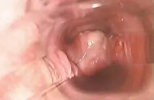 Ficken zwei am Pool  ...