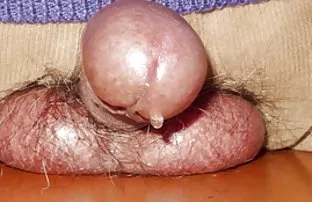 Fickt und leckt Fotz ...